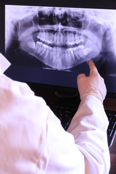 Best Emergency Wisdom Tooth Extraction in Point Mackenzie, AK